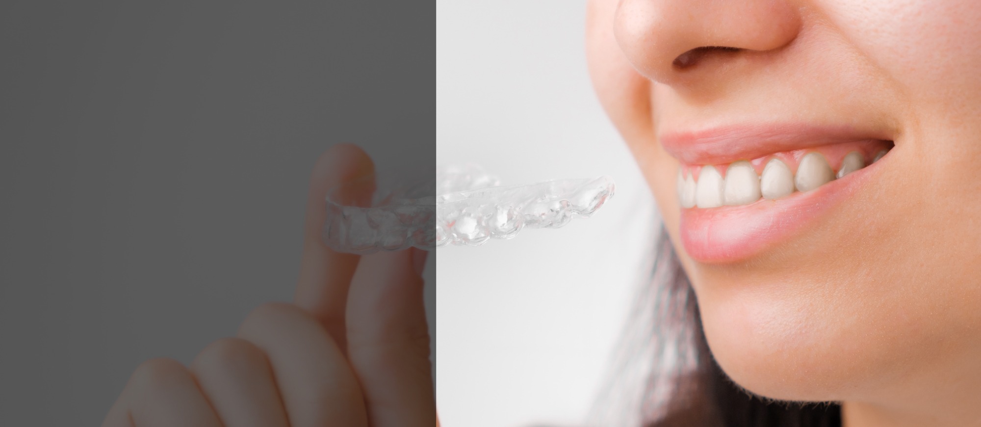 Elk-Plaza-Dental-Homepage-Slide2